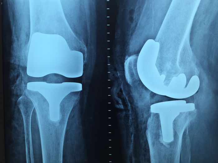 Orthopedics